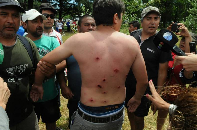 Los manifestantes recibieron heridas con balas de goma.