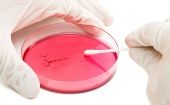 La OMS considera que existe una "prioridad crítica" para el hallazgo de nuevos medicamentos frente a estas 12 familias de bacterias. 