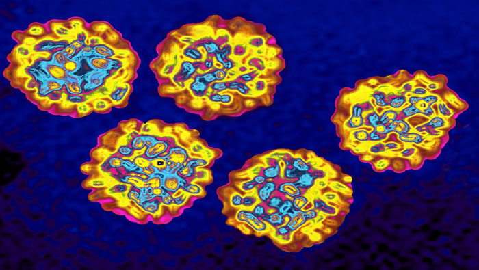 El estudio demostró que la hepatitis viral continúa figurando entre los diez principales asesinos globales.