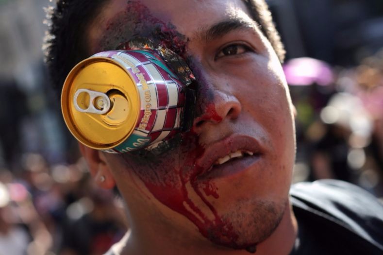 A 'walker' poses with a decorative can on his eye at the Zombie Walk in Mexico City.