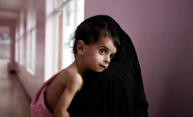 More than 11 million children, out of the entire 29 million Yemeni population, need humanitarian assistance.