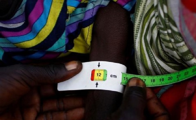 A child is checked for signs of malnutrition by a United Nations International Children's Emergency Fund health in Thonyor