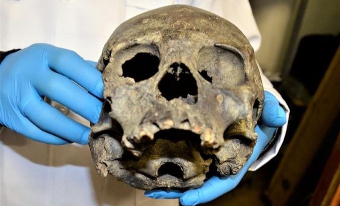 A skull from a person from the Tiahuanaco pre-Hispanical culture is shown at the Bolivian Cultures and Tourism Ministry.