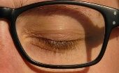 Si percibes que lo tienes hinchado y no puedes abrir o cerrar los ojos, acude al oftalmólogo o a tu médico de cabecera.