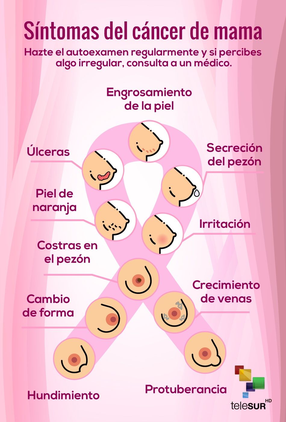 Identifica estos síntomas y detecta el cáncer de mama