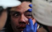 Anteriormente, el Instituto de Derechos Humanos de Chile, había indicado en su último reporte que 352 personas habían sufrido lesiones oculares.