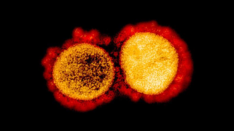 Una micrografía electrónica muestra la transmisión de partículas del virus del SARS-CoV-2, aisladas de un paciente. La imagen fue capturada y mejorada en color en la Instalación de Investigación Integrada (IRF) del Instituto Nacional de Alergias y Enfermedades Infecciosas (NIAID) en Maryland, EE.UU.