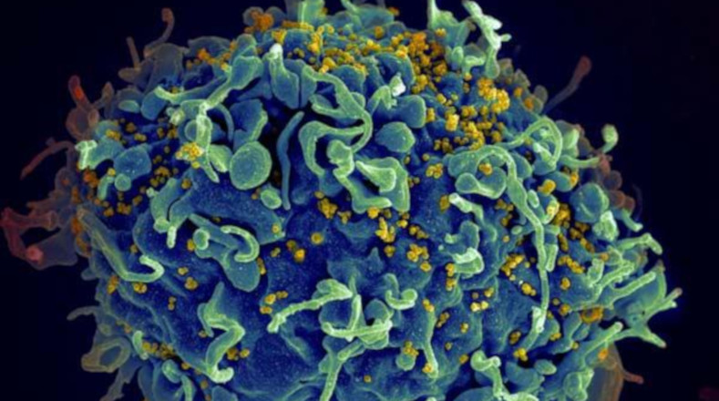 Esta célula T humana (azul) está siendo atacada por el VIH (amarillo), el virus que ocasiona el Síndrome Inmunodeficiencia Adquirida (SIDA). En la imagen se observa como el virus se dirige específicamente a las células T, que desempeñan un papel fundamental en la respuesta inmunitaria del cuerpo contra invasores como bacterias y virus. 