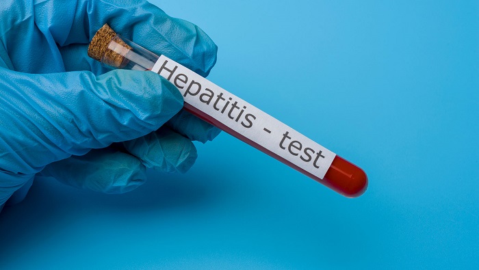La hepatitis es una inflamación del hígado, órgano vital encargado de filtrar la sangre, combatir infecciones y procesar nutrientes.