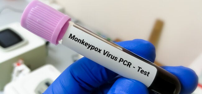 Hasta el momento, EE.UU. ha detectado más de 6.500 casos de viruela del mono, aunque las autoridades prevén que los contagios aumenten en las próximas semanas.