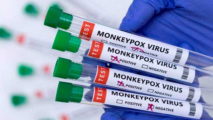Recientes estudios en España indican que el brote de viruela del mono se considera leve, a pesar de ser el segundo país con mayores casos.