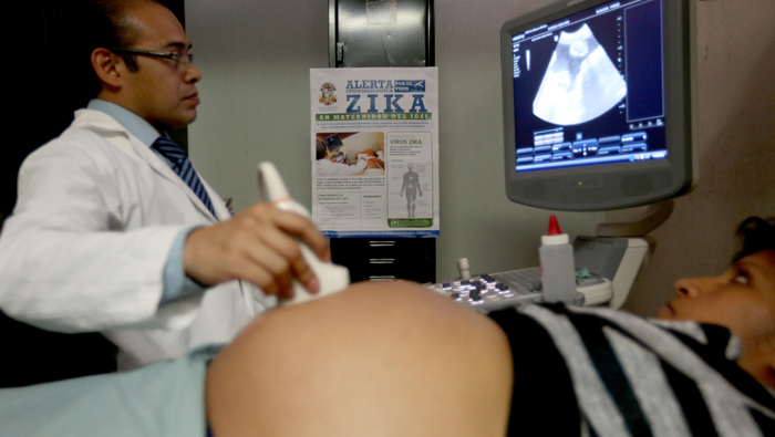 Colombia registra un total de 5 mil mujeres embarazadas contagiadas con el virus Zika.