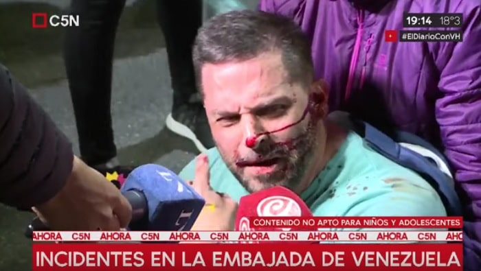 La Policía Metropolitana decidió atacar a las simpatizantes del chavismo.