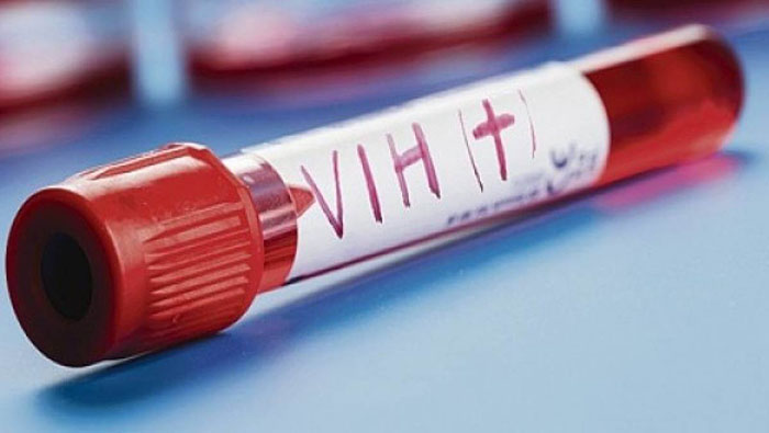 Naciones Unidas estipula que en el planeta hay actualmente 37.9 millones de personas infectadas por el VIH.
