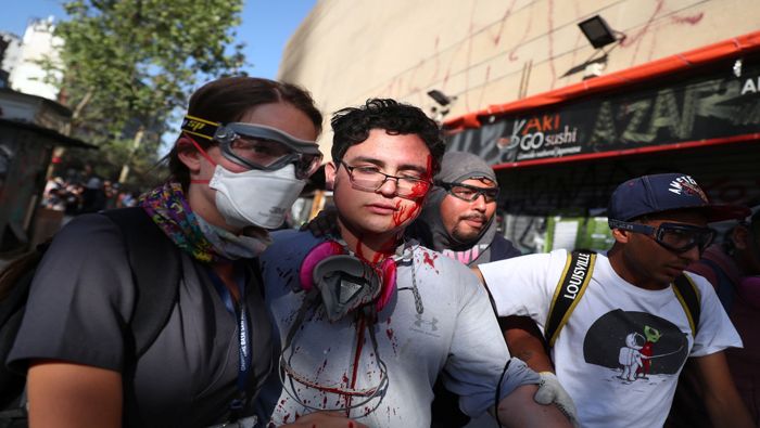 El INDH de Chile ha registrado que, durante las fuertes represiones contra las protestas, más de 200 personas han sufrido lesiones oculares.