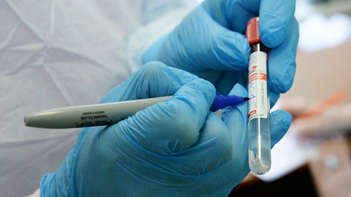 La cifra de test de coronavirus realizados por día convierte a Rusia en líder en este campo.