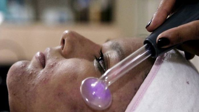 Paciente diagnosticada con lupus es afectada por brotes en el rostro.