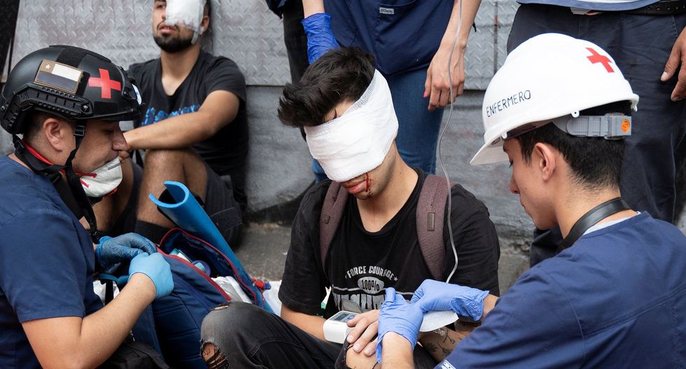 Más de 200 jóvenes perdieron la visión por disparos de perdigones por Carabineros, durante las manifestaciones en octubre pasado.