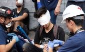 Más de 200 jóvenes perdieron la visión por disparos de perdigones por Carabineros, durante las manifestaciones en octubre pasado.