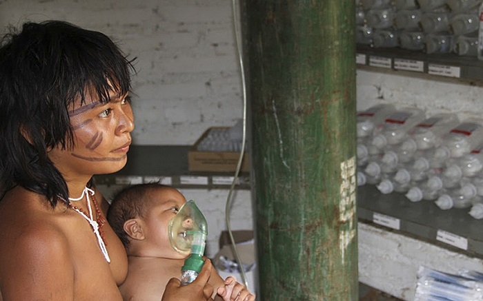Los menores de cinco años son de los más afectados por causa de los efectos de los incendios en la Amazonía.