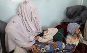 Los habitantes de zonas de conflicto sufren más la desnutrición, como Afganistán, donde más de 23 millones de afganos padecen hambre.