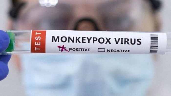 Al paciente se le confirma positivo a la viruela del mono tras tomarle muestras, las cuales se enviaron al laboratorio del Instituto de Medicina Tropical Pedro Kourí.